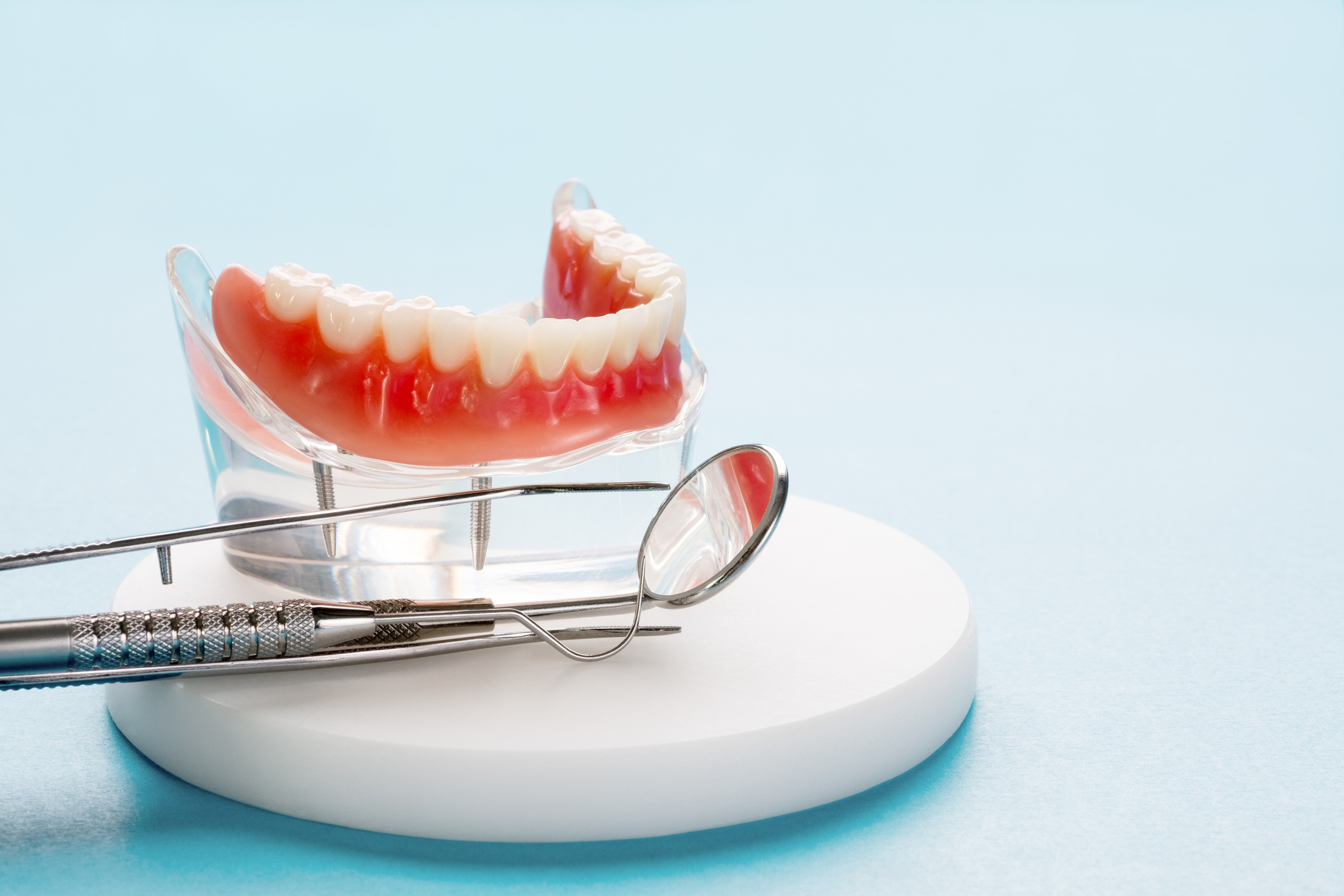 Benefits of Snap-on Dentures