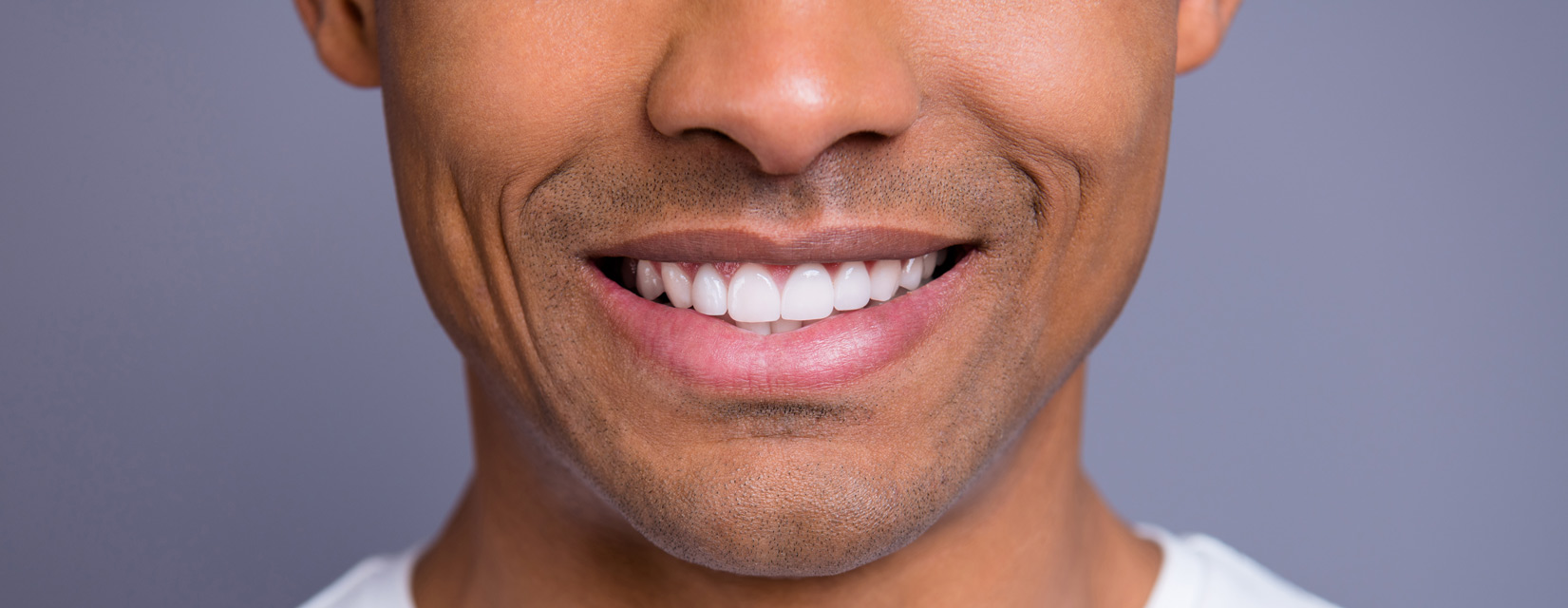 Laser Teeth Whitening vs. Whitening Trays